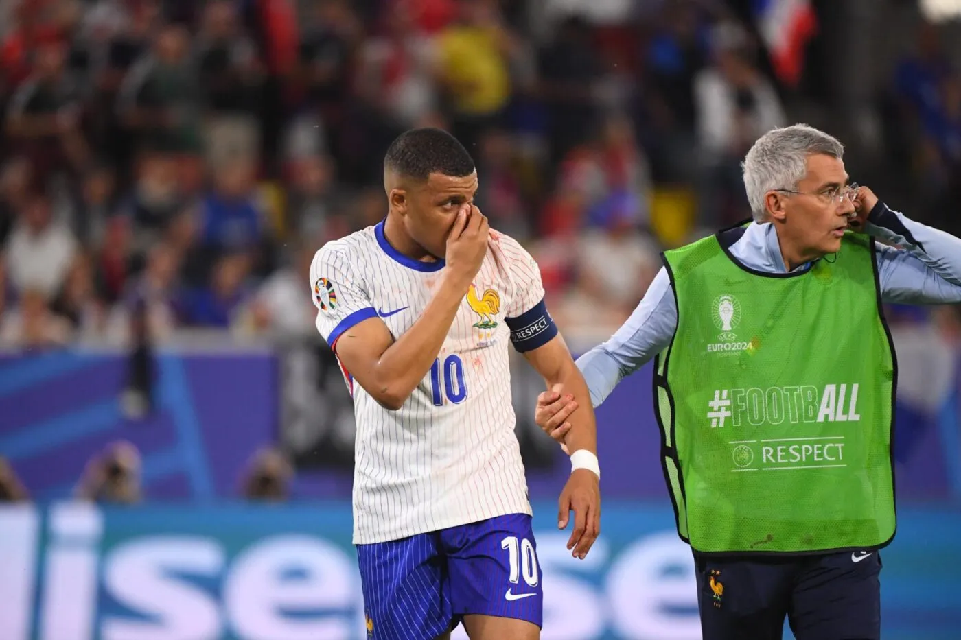 Le staff des Bleus communique sur la blessure au nez de Mbappé