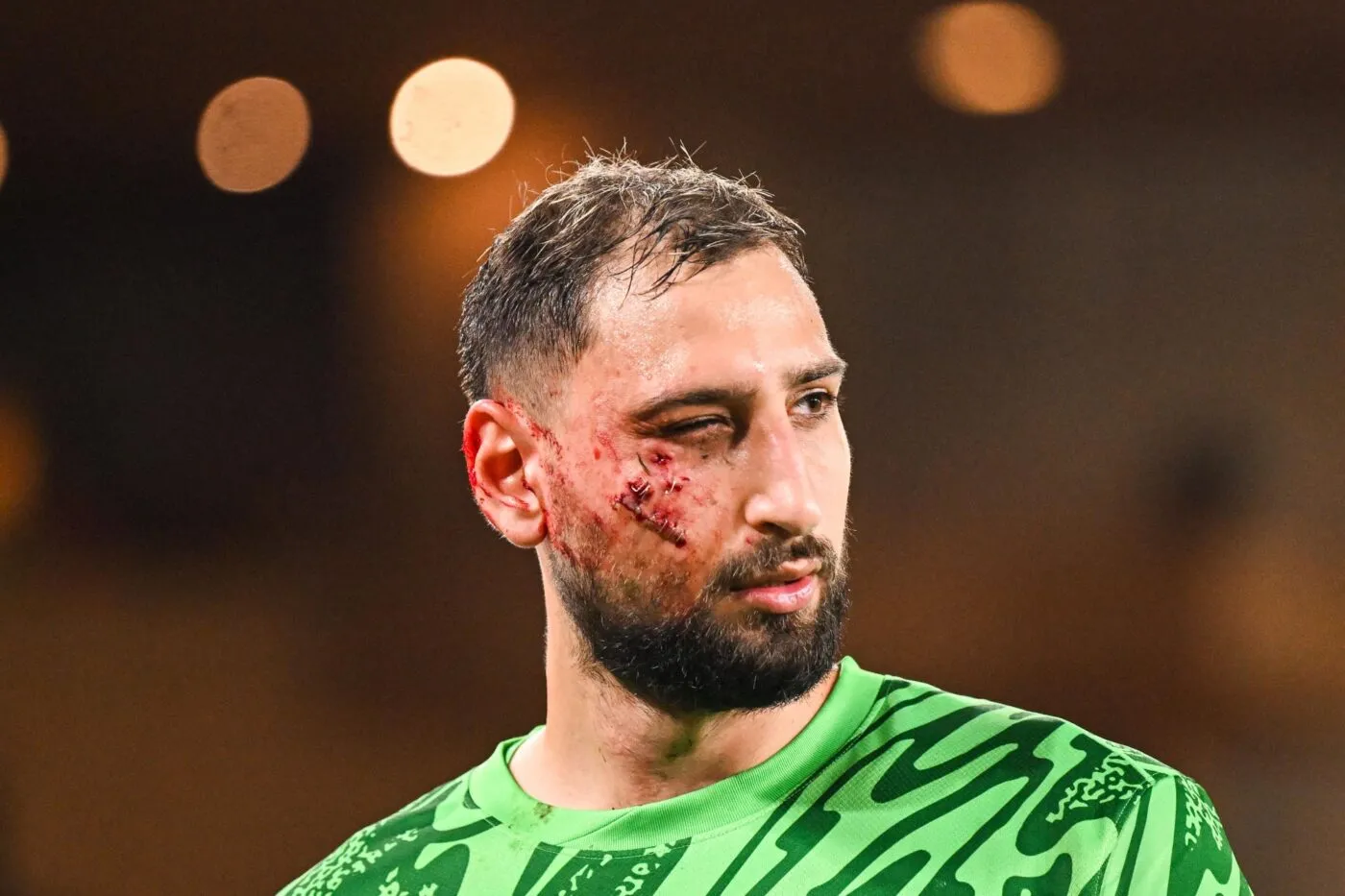 L’impressionnante balafre de Donnarumma au visage