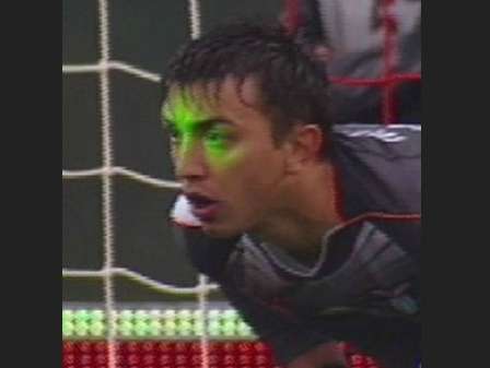 Photo : Muslera et le laser