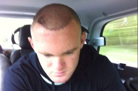 Photo : les cheveux de Rooney