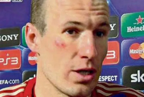 Photo : le cocard de Robben