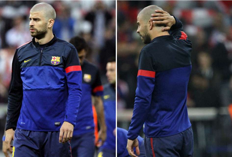 Photo: Piqué sans cheveux